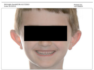 Children’s Oral Appliances