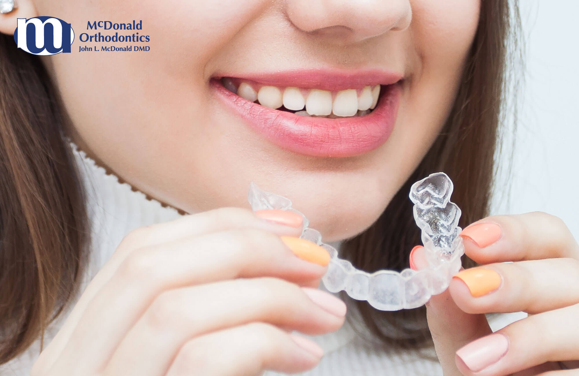 DIY clear braces or clear aligners can seem like a convenient option, but the lack of a supervised treatment can leave much to be desired.